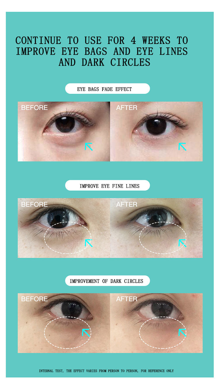 JUJY Pro iHero Eyes Care Massager