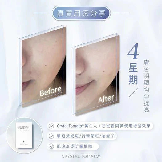 Crystal Tomato Whitening Supplement (30caps/box)